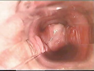 Porno vidio mama ir sūnus viduje pūlingas per vyrus l7 keistai metu